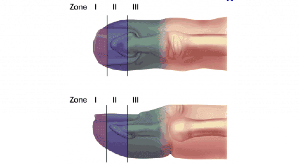 Finger Tip Zones