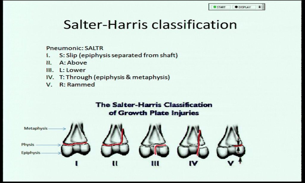 salter_harris_classification