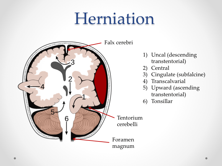 Dilatation 