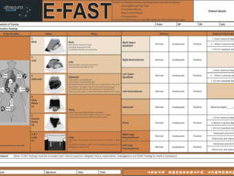 extended focused assessment with sonography in trauma Archives ...