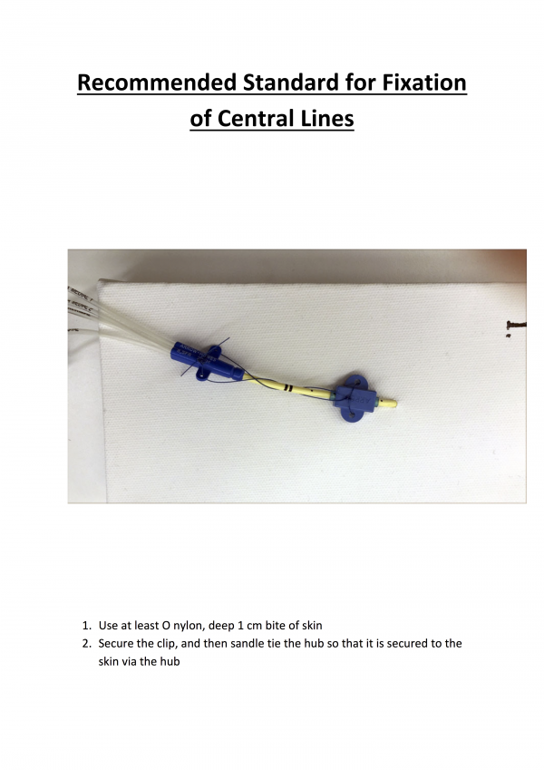 Standard for Fixation of Central Lines Charlie's ED