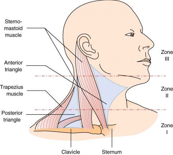 Zones of the neck - Charlie's ED